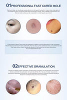 Amazing Laser Freckle & Mole Removal Pen