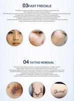 Amazing Laser Freckle & Mole Removal Pen