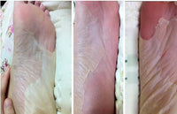 Exfoliating Foot Peel