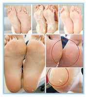 Exfoliating Foot Peel