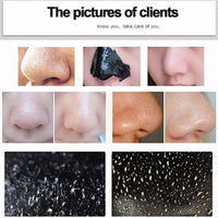 Face Mask Blackhead Remover