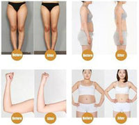 Cellulite Removal Cream