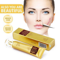 Original Acne Scar Removal Cream